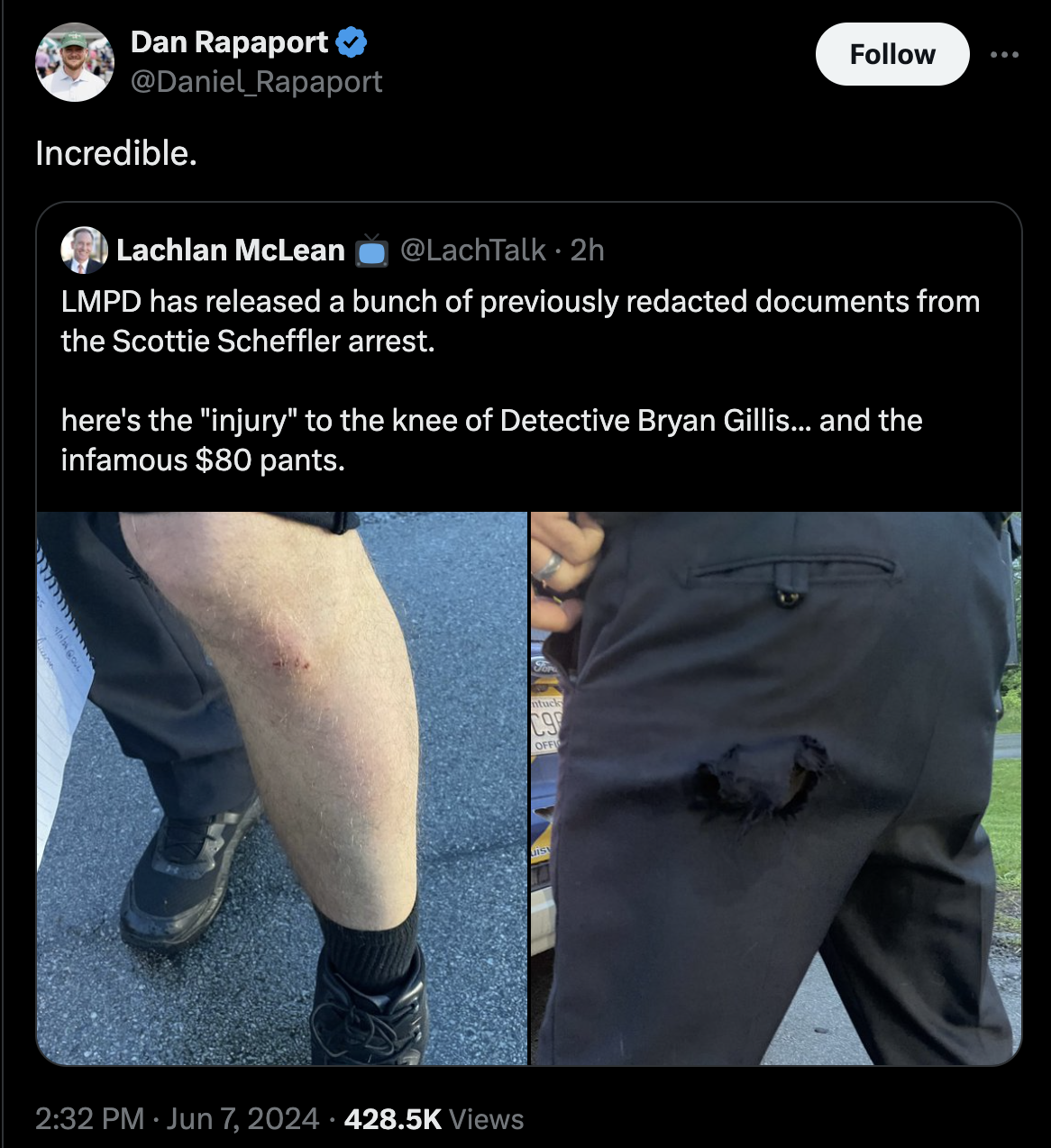 screenshot - Dan Rapaport Rapaport Incredible. Lachlan McLean . 2h Lmpd has released a bunch of previously redacted documents from the Scottie Scheffler arrest. here's the "injury" to the knee of Detective Bryan Gillis... and the infamous $80 pants. Views